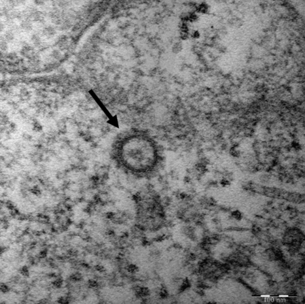코로나19 바이러스(SARS-CoV-2)의 고해상 전자현미경 사진. (사진=질병관리본부 제공)