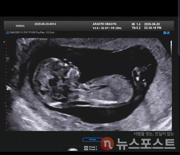 늦은 결혼과 출산 등의 영향으로 자연스럽게 난임 인구가 증가하고 있다. (사진=뉴스포스트 이해리 기자) 