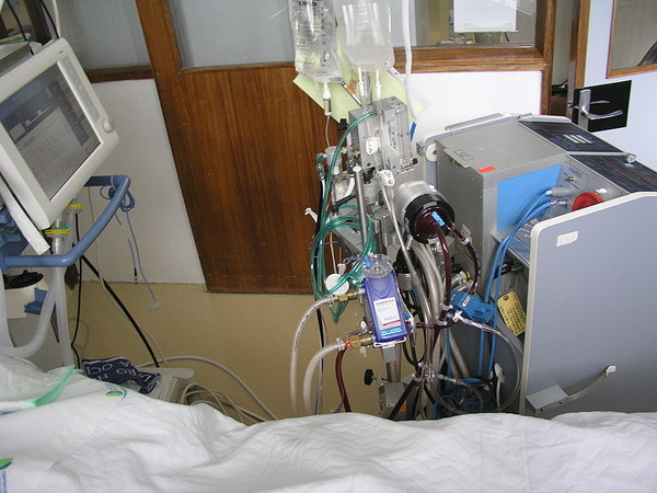 에크모 장치. 심장 등의 기능이 떨어진 환자의 혈액을 빼내 산소를 공급한 뒤 다시 몸속으로 넣는 역할을 한다. (사진=Wikimedia Commons.) 