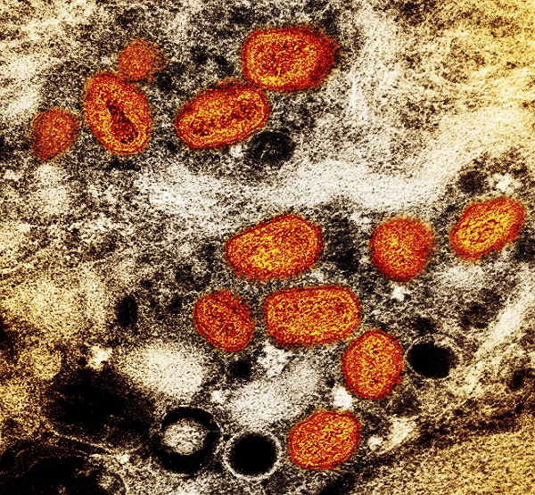 미국 국립알레르기감염병연구소(NIAID)가 제공한 사진으로, 실험실에서 배양한 감염된 세포(갈색) 내 원숭이두창 입자(주황색)이 투과전자현미경에서 보이고 있다. (사진=AP/뉴시스)